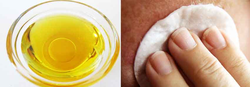 Лечение псориаза АСД фракцией 2 и 3 — Dermatox.ru